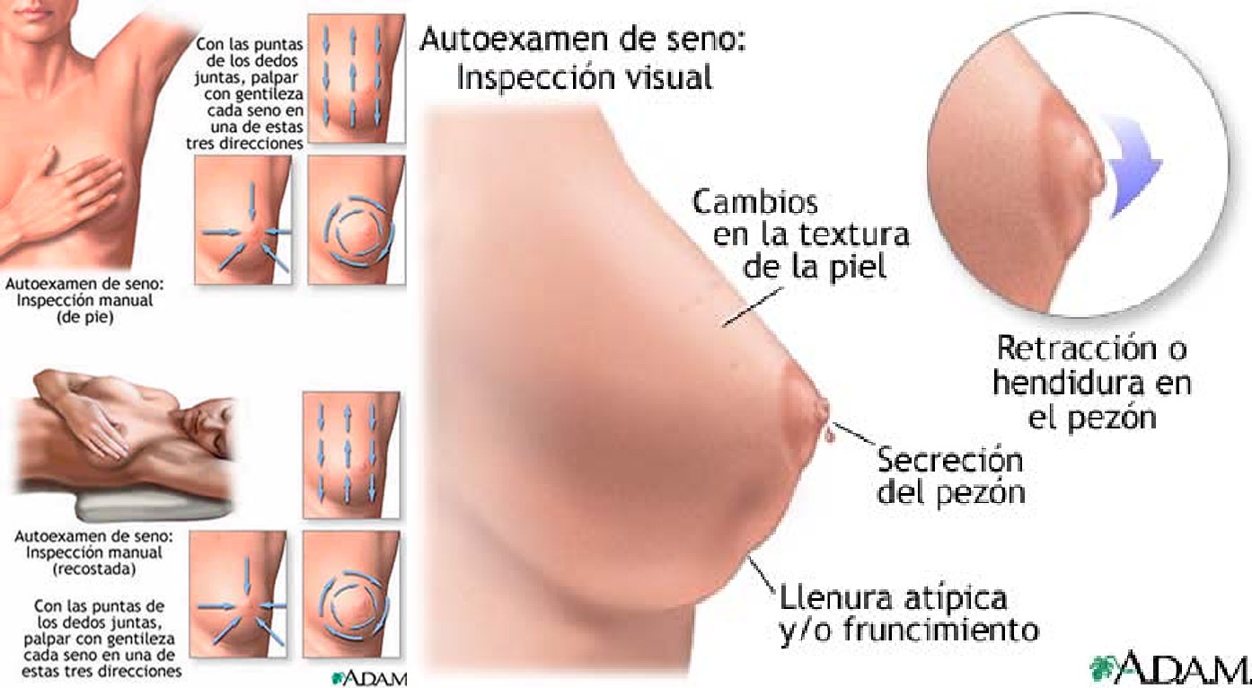 Prueba Este Volcan Deseosa De Sexo 2030